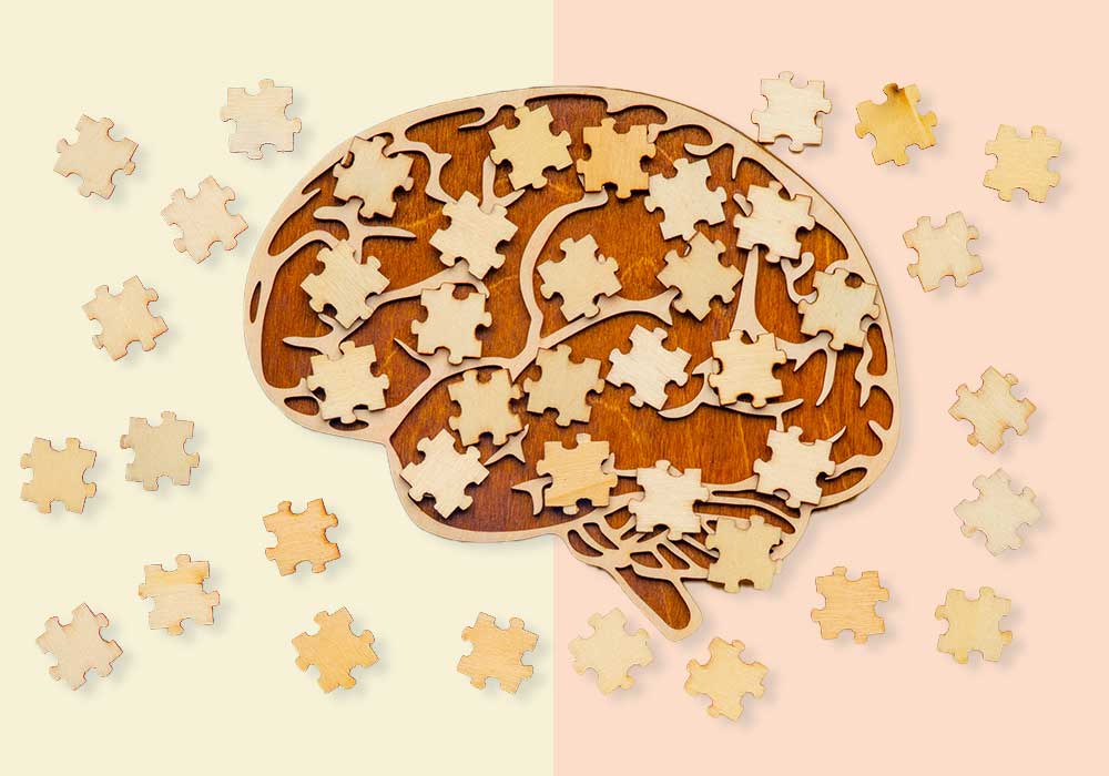 cerebro estrellas esquema neurodivergencia trabajo